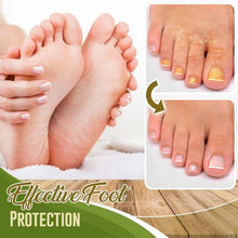 Load image into Gallery viewer, Foot Deodorant and Dehumidification Spray