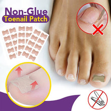 Load image into Gallery viewer, Non-Glue Toenail Patch