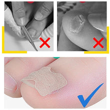 Load image into Gallery viewer, Non-Glue Toenail Patch