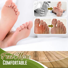Load image into Gallery viewer, Foot Deodorant and Dehumidification Spray