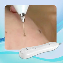 Load image into Gallery viewer, Facial Spots Removal Pen