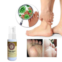 Load image into Gallery viewer, Foot Deodorant and Dehumidification Spray