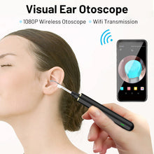 Load image into Gallery viewer, Wireless Ear Wax Removal Tool