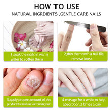 Load image into Gallery viewer, Nail Repair Treatment Gel