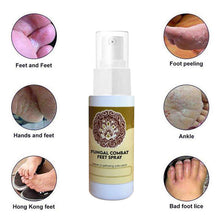 Load image into Gallery viewer, Foot Deodorant and Dehumidification Spray